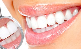 Профессиональные методы отбеливания зубов: что выбрать?