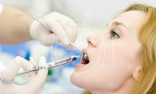 Анестезия в стоматологии. Какой выбрать анестетик?