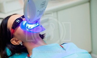 Фотоотбеливание зубов. Профессиональные системы фотоотбеливания