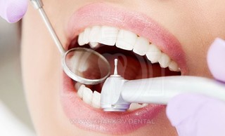 Пломбирование зубов, виды зубных пломб