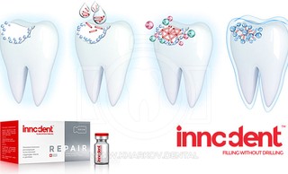 Препарат InnoDent – природная регенерация зубной эмали