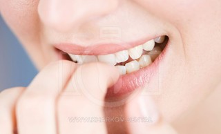 Привычки, которые разрушат наши зубы