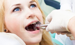 Возможность удаления зубов без боли