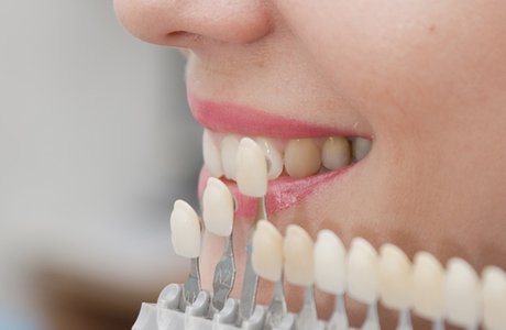Что такое художественная реставрация зубов, чем она отличается от пломбы?