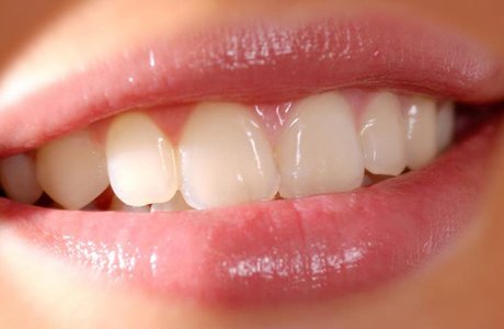 Чистка и уход за зубными протезами, хранение зубных протезов
