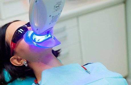 Фотоотбеливание зубов. Профессиональные системы фотоотбеливания