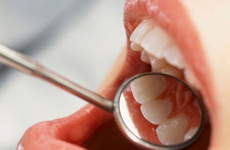 Классификация кариеса зуба