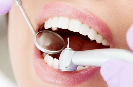 Пломбирование зубов, виды зубных пломб